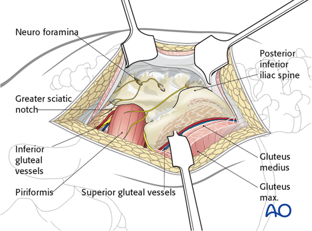 posterior approach to the si joint
