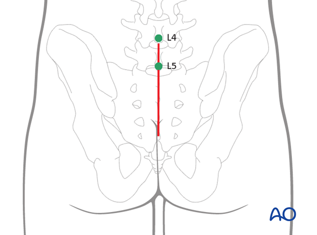 Sacrum