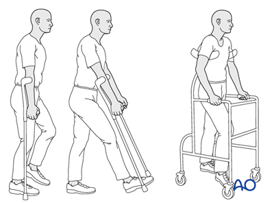 Nonoperative for Pubic ramus fractures