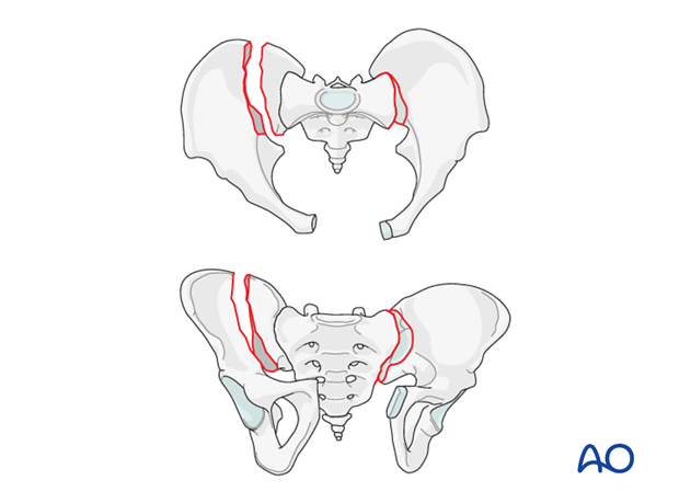 operative treatment