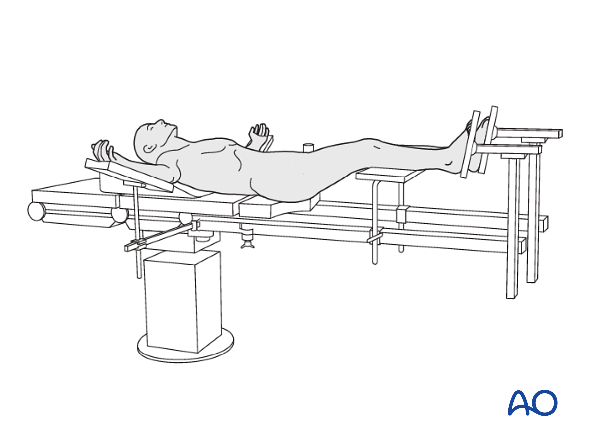 Supine position