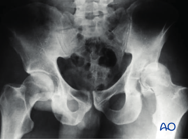 decision making nonoperative vs surgical treatment