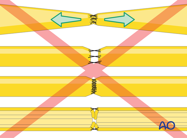 How not to repair nerves