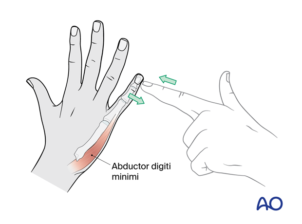 70 X070 Ulnar and median nerve lesions