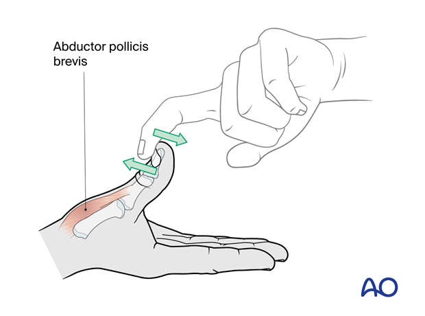 Checking the power of the abductor pollicis brevis