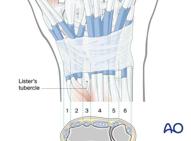 Extensor sheaths and retinaculum