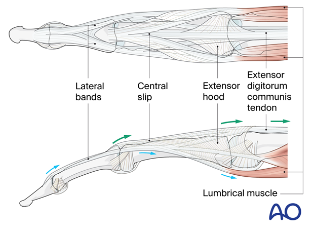 Extensor tendon mechanism