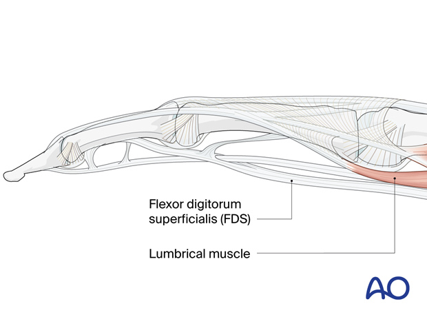 Lateral aspect of the extensor and flexor tendons in the finger