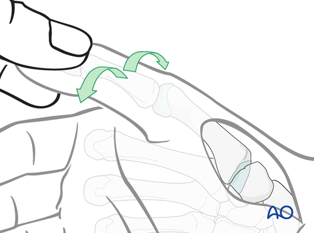 Inspect the joint by rotating the thumb into pronation and supination, whilst exerting longitudinal traction.