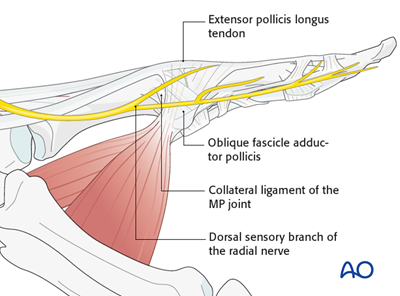 Dorsoulnar approach to the MCP joint of the thumb