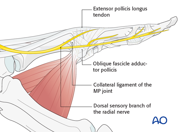 collateral ligament hand