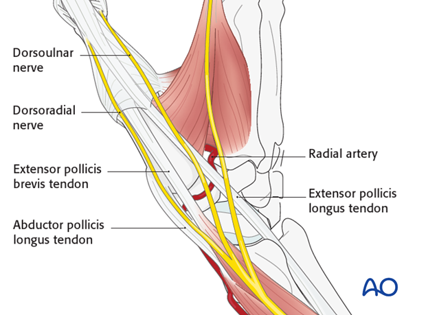In the subcutaneous tissue, the dorsoulnar and dorsoradial divisions of the dorsal sensory branch of the radial nerve ...