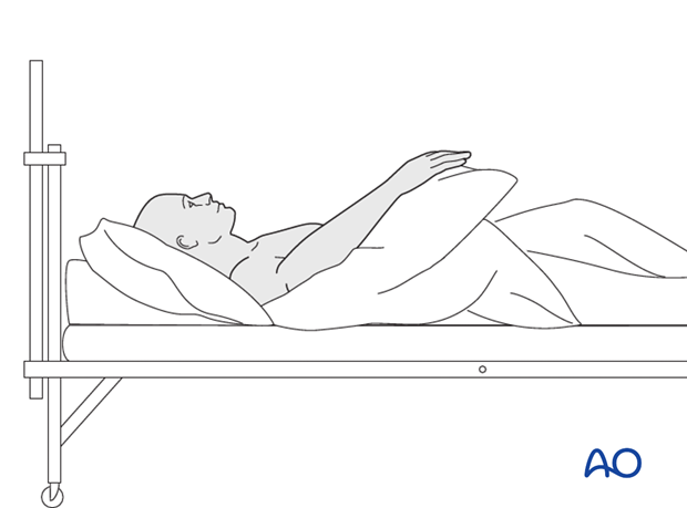 While the patient is in bed, use pillows to keep the hand elevated above the level of the heart to reduce swelling.