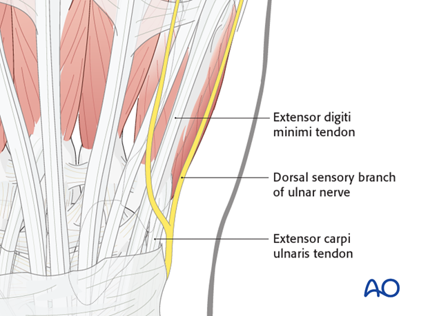The extensor tendons of the little finger converge slightly towards the center of the wrist joint. The dorsal sensory branch ..