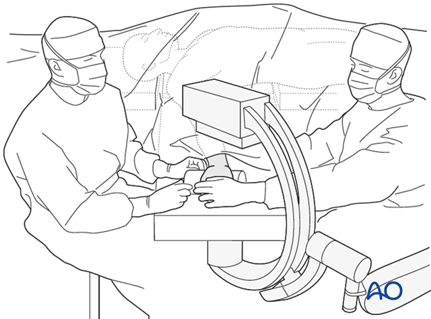Anatomical structures for minimally invasive access to the scaphoid