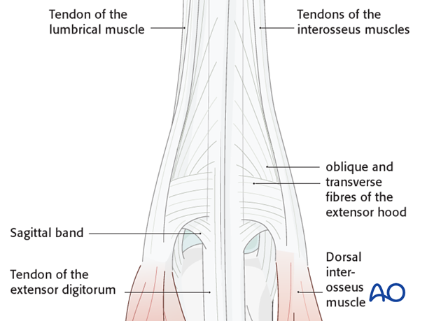 The tendons of the extensor digitorum and the extensor hood cover the MCP joints dorsally. The extensor tendon receives the ...