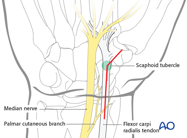 Palmar approach to the scaphoid - Landmarks