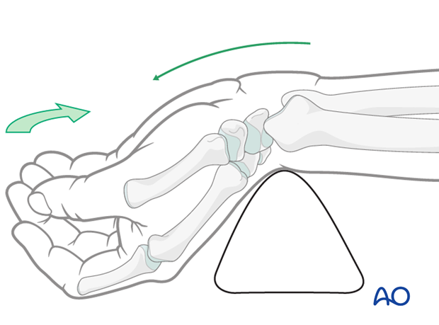 Anatomical structures for minimally invasive access to the scaphoid