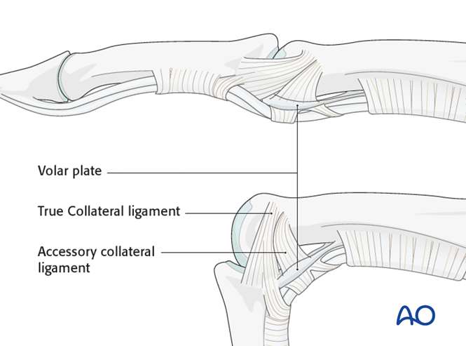 Midaxial approach to the PIP joint