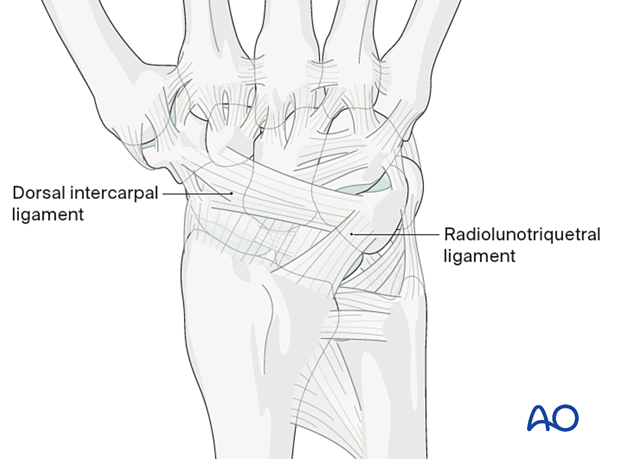 Position of the radiolunotriquetral ligament