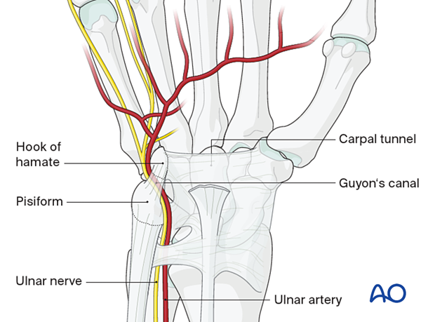 Location of the carpal tunnel and Guyon’s canal