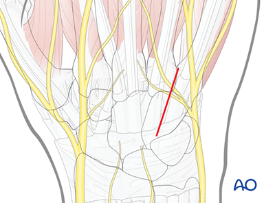 Dorsal approach to the carpometacarpal joints