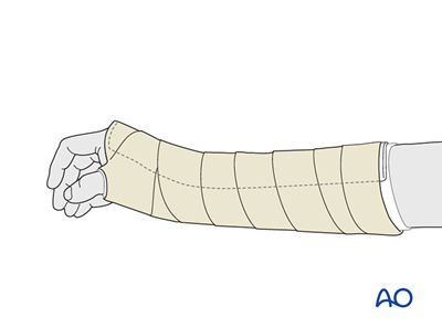 Reduction - Immobilization for Dislocation and fracture-dislocation of ...