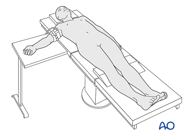 Patient lying in a supine position with arm on a radiolucent side table