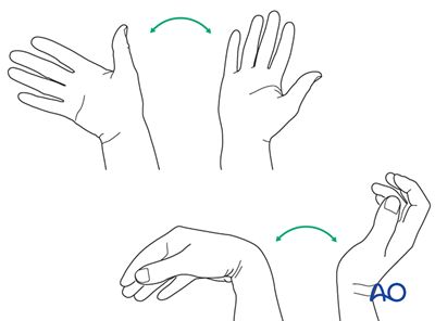 Postoperative Treatment Of Carpal Injuries