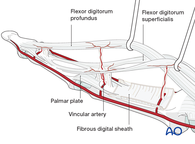 Vascularity of flexor tendons by vincular arteries  