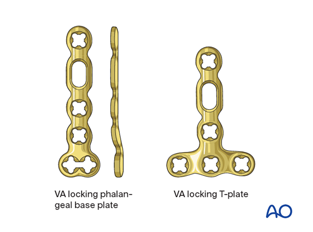 Variable-angle locking phalangeal base plate and a variable-angle locking T-plate.