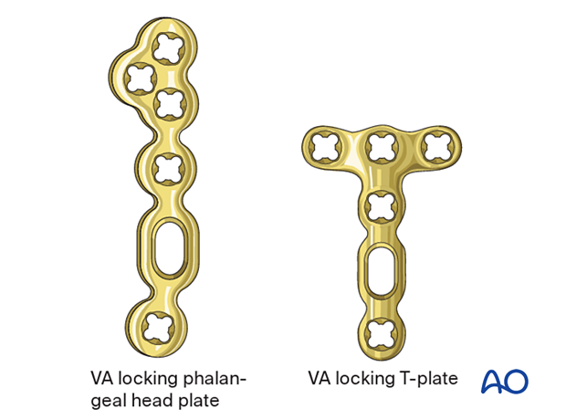 Variable-angle locking phalangeal head plate and a variable-angle locking T-plate.