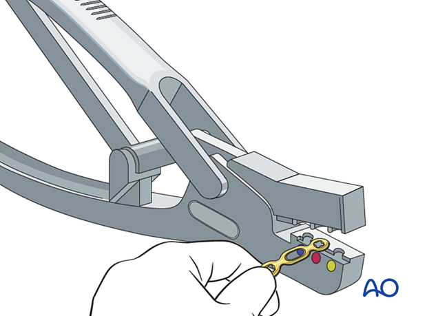 Trimming the plate to fit the length of the proximal phalanx.