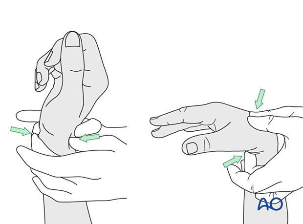 Tenodesis effect