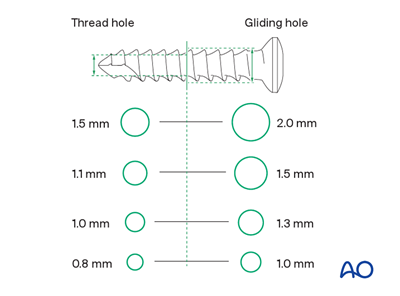 Lag-screw fixation for Avulsion at the proximal end segment