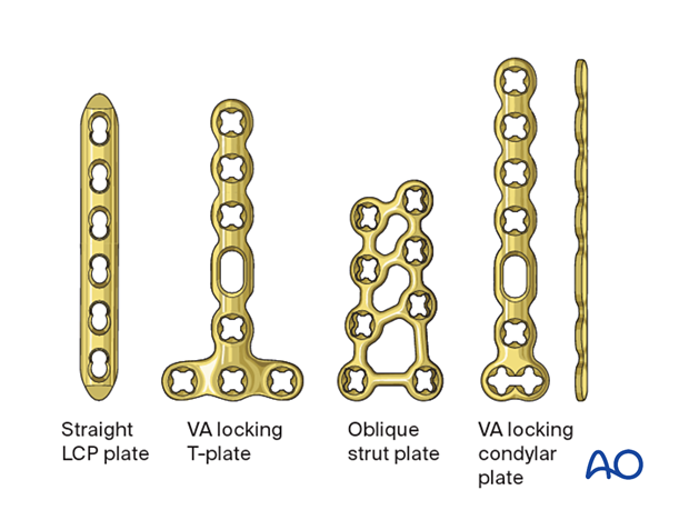 Selection of plates for application if the proximal phalanx