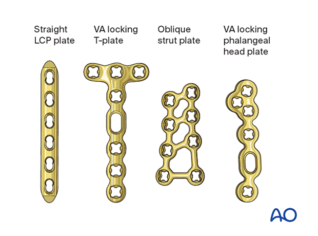 Selection of plates for fixation of a proximal phalangeal fracture