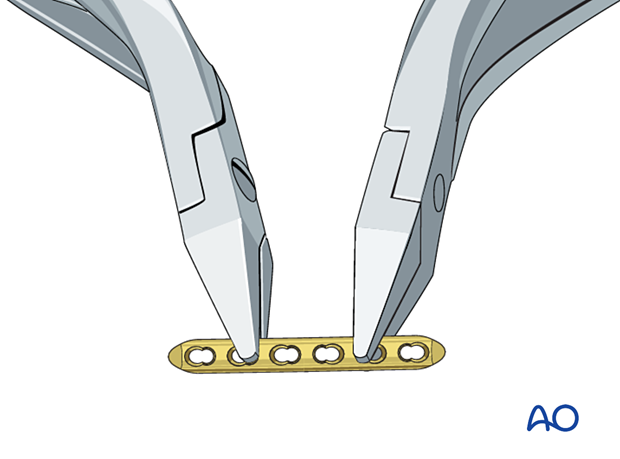 Plate contouring for fixation of a proximal phalangeal fracture