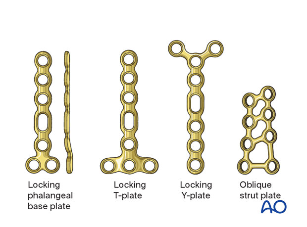Plate fixation of middle phalangeal base fracture, use phalangeal base plate for comminuted articular fracture reduction.