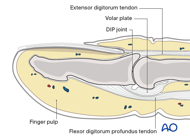 Anatomical structures of the distal phalanx and the DIP joint