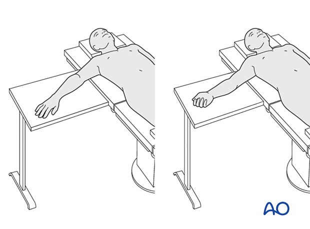 Patient in supine position with the arm on a side table and the hand in supination and pronation