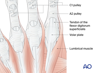 Volar approach to the metacarpophalangeal joint