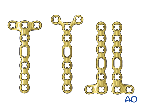 VA locking screws for plate fixation of metacarpal fractures