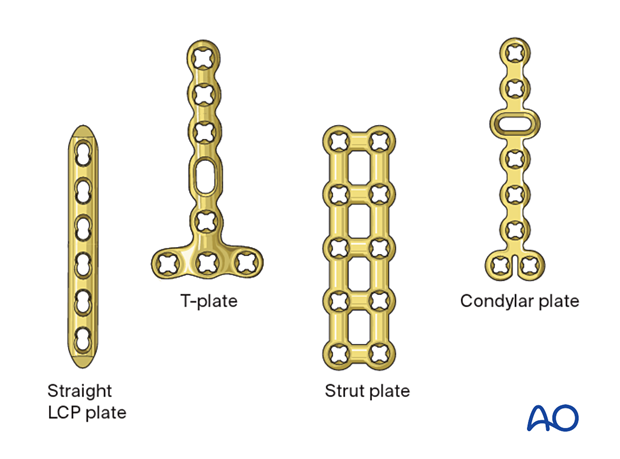 Plate selection for bridge plating of a multifragmentary fracture of a metacarpal shaft