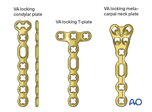 Plates for fixation of extraarticular metacarpal fractures