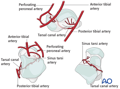 Medial malleolar osteotomy