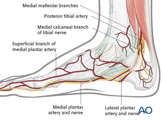 Anteromedial approach to the talus