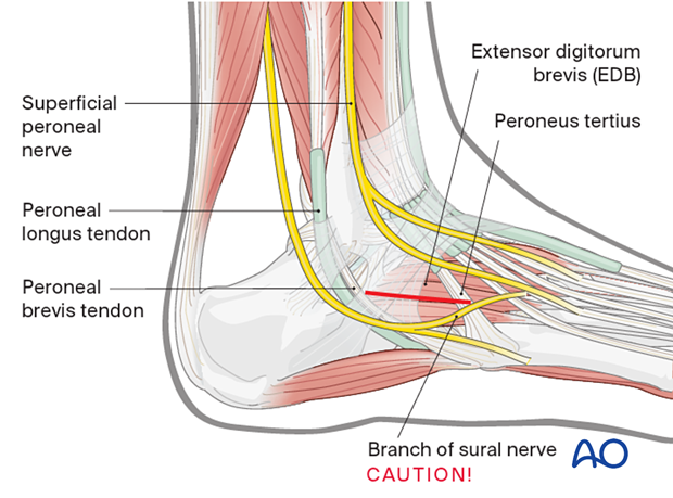 Sural nerve in the foot