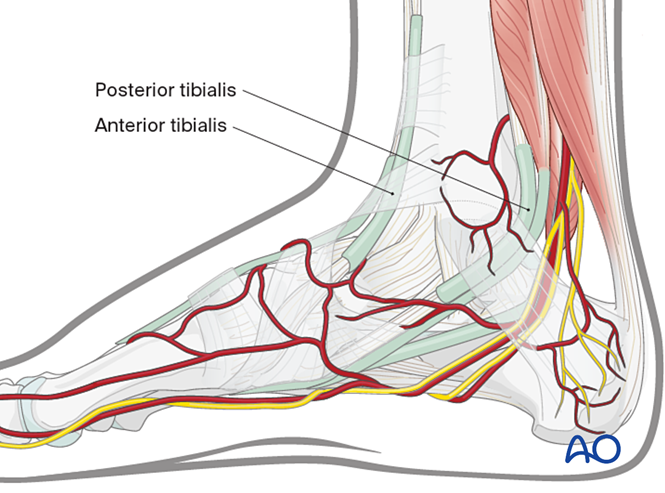 Medial utility incision to the midfoot