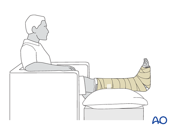 Patient seated with the foot immobilized in a plaster splint and the leg elevated on a cushion